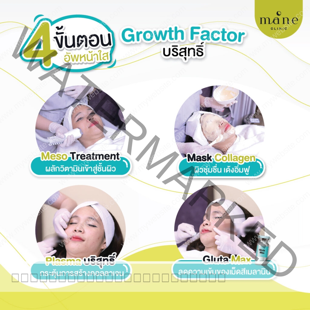 Plasma แก้ฝ้า จัดการฝ้า อัพหน้าใส mane clinic