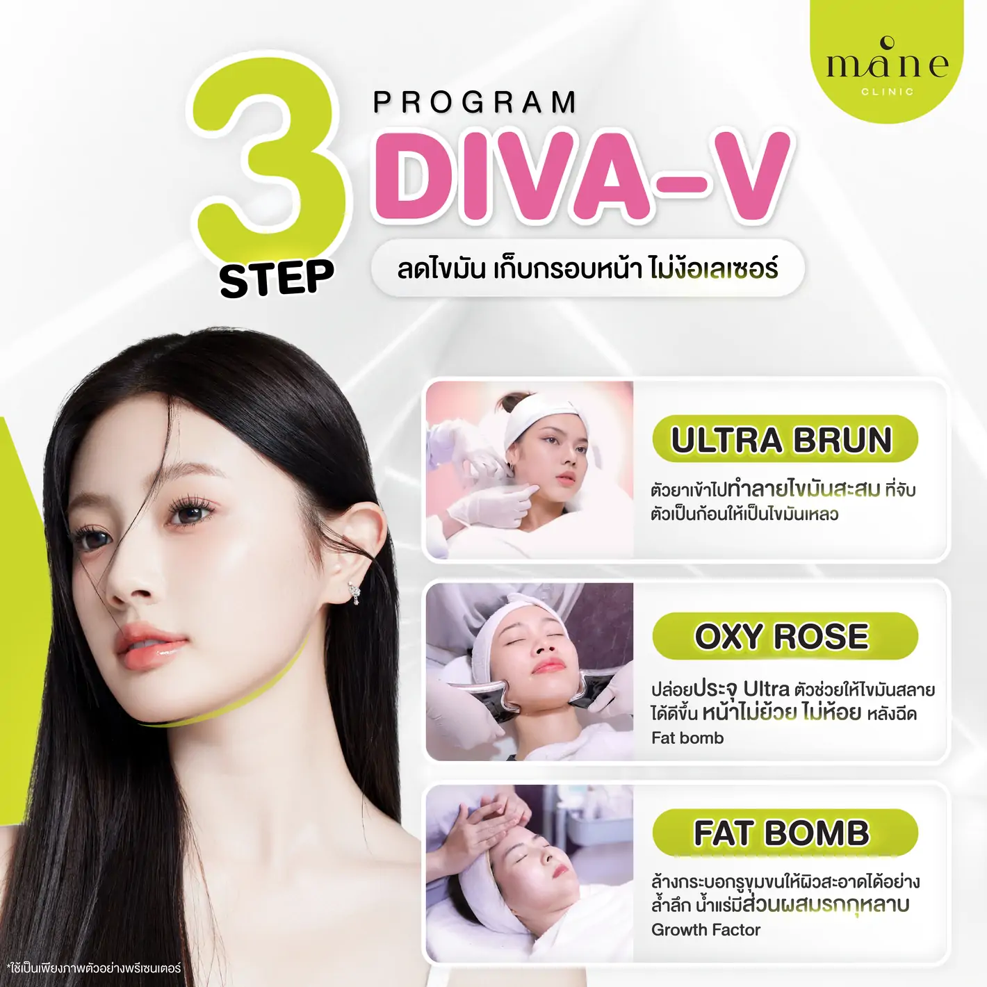 3 step diva-v