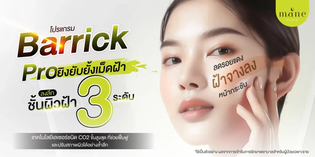 Barrick Pro