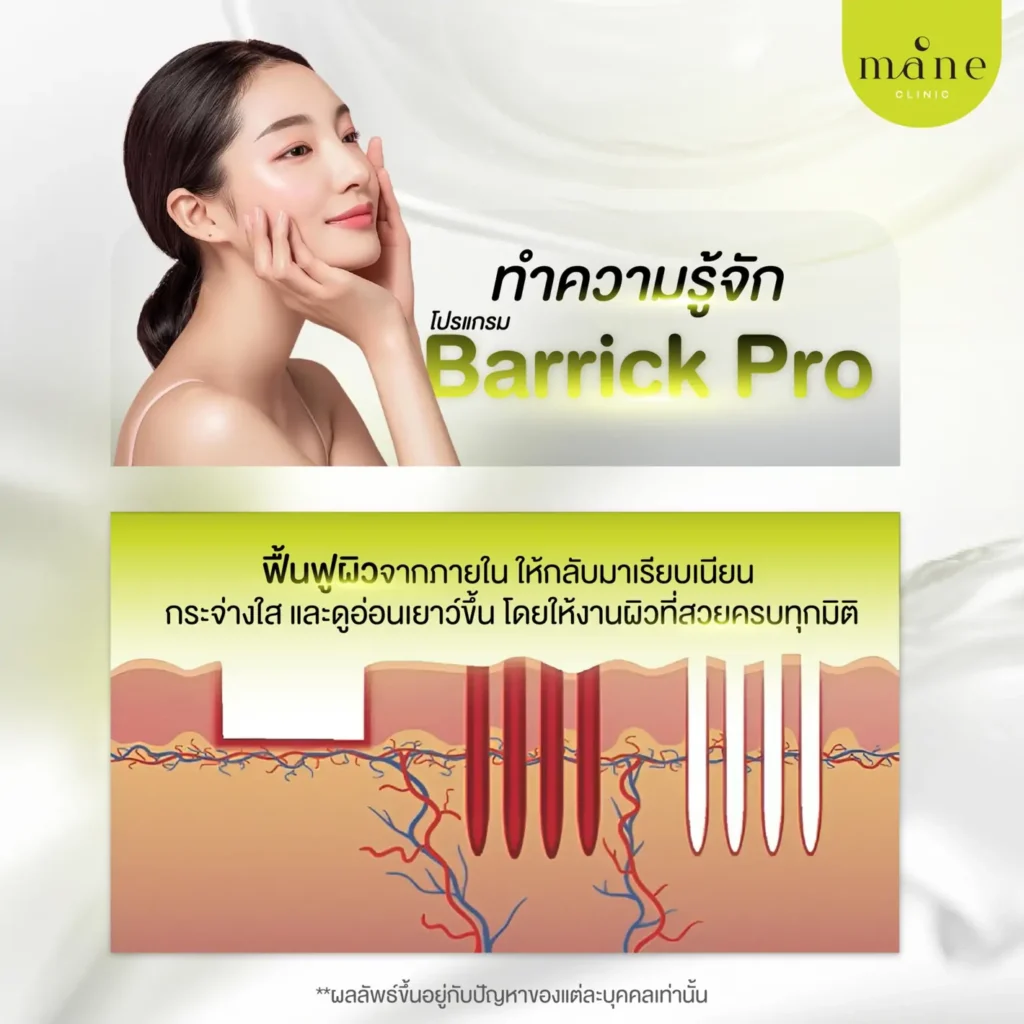 ทำความรู้จัก Barrick pro