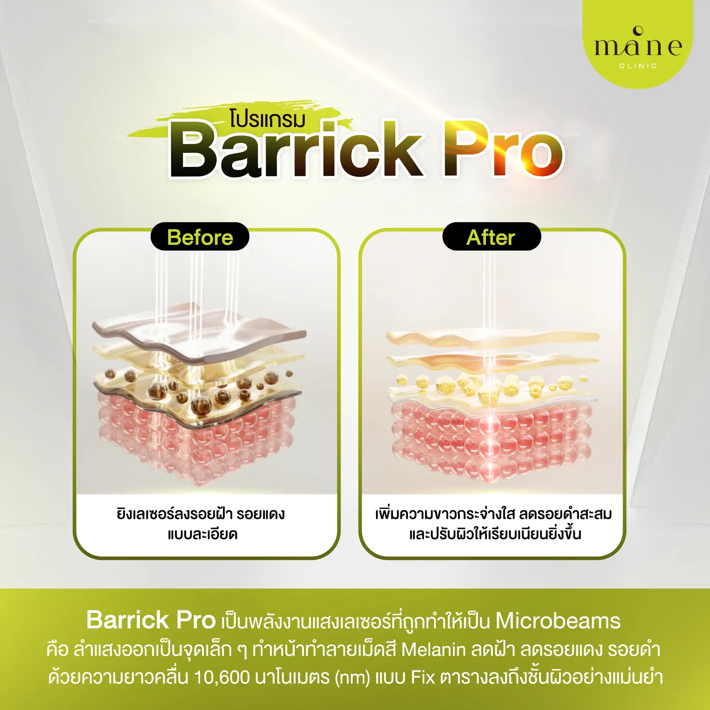 โปรแกรม Barrick Pro