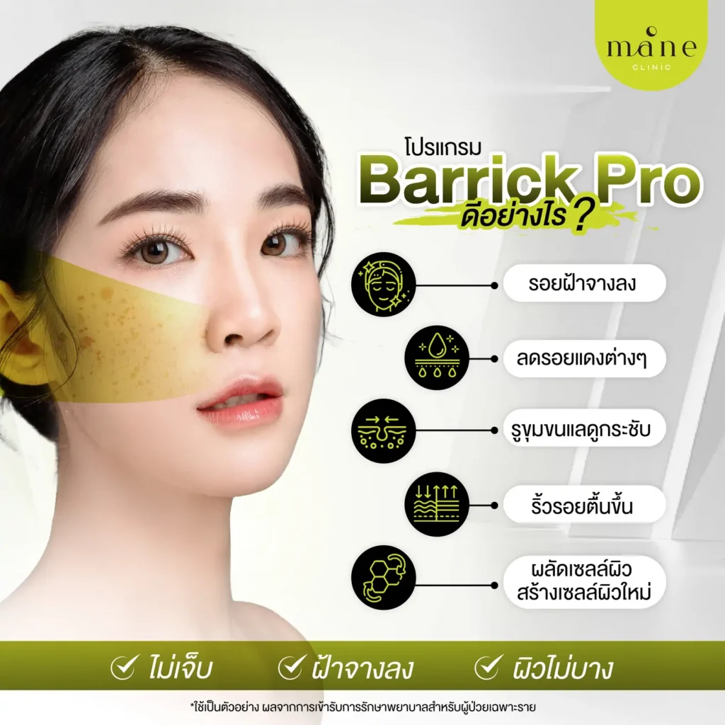 โปรแกรม barrick pro ดีอย่างไร