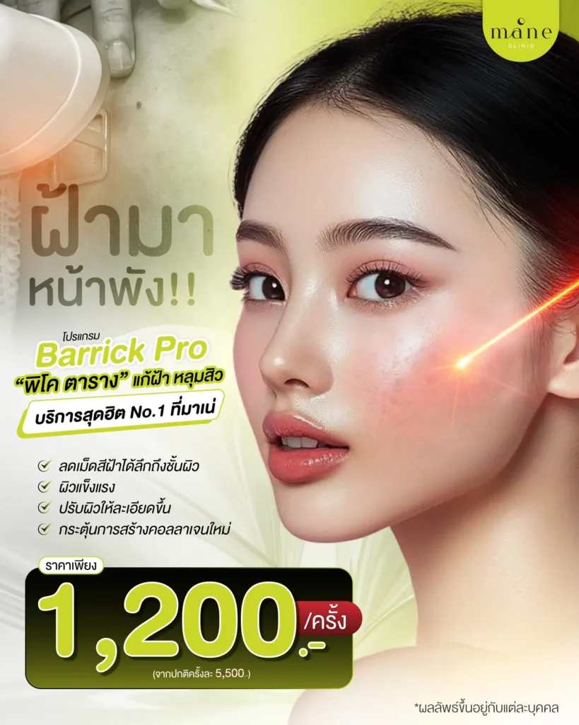 ฝ้ามาหน้าพัง