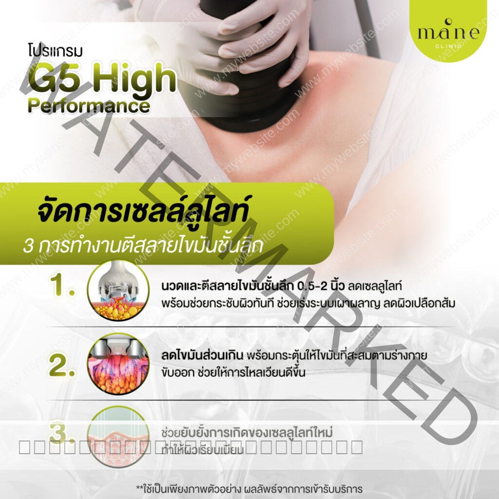 จัดการเซลล์ลูไลท์