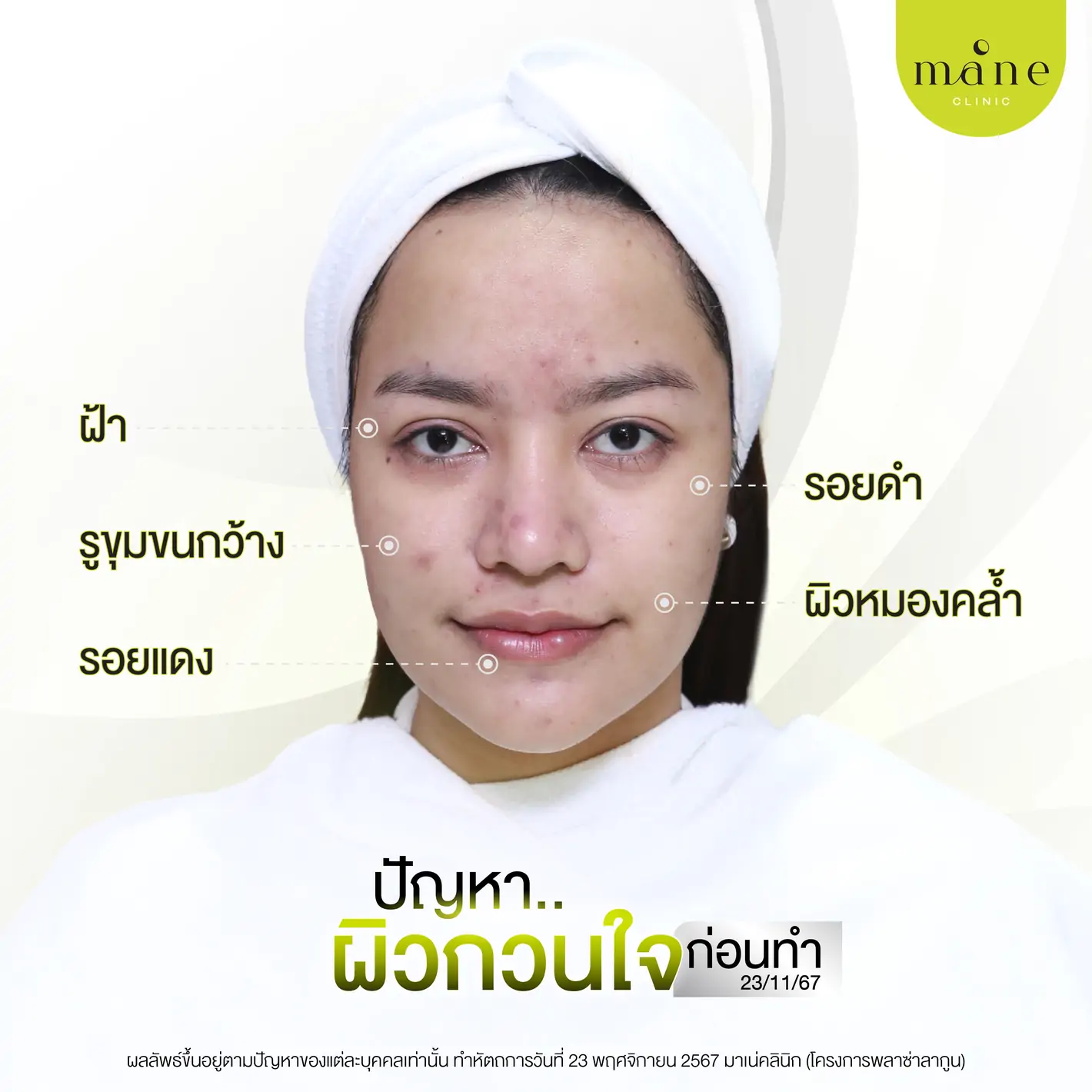 ปัญหาก่อนทำ
