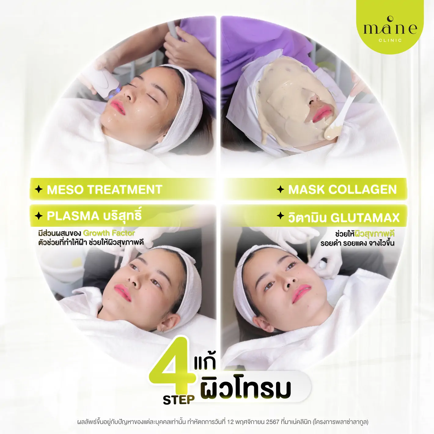 4 step แก้ผิวโทรม