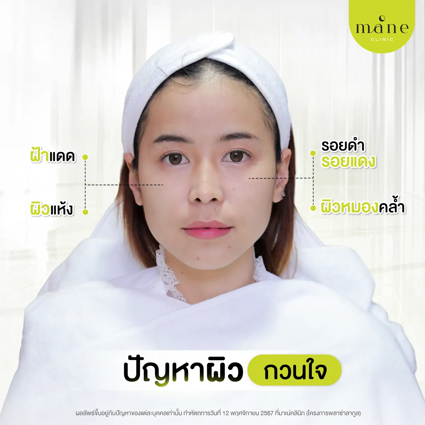 ปัญหาผิวกวนใจ