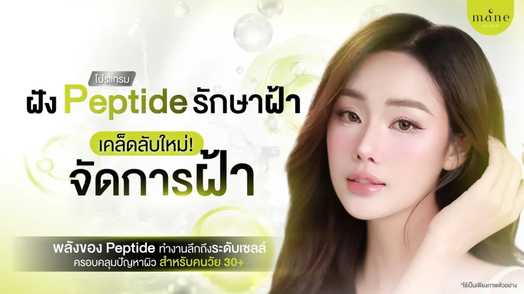 ฝัง peptide รักษาฝ้า