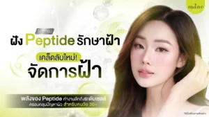 ฝัง peptide รักษาฝ้า