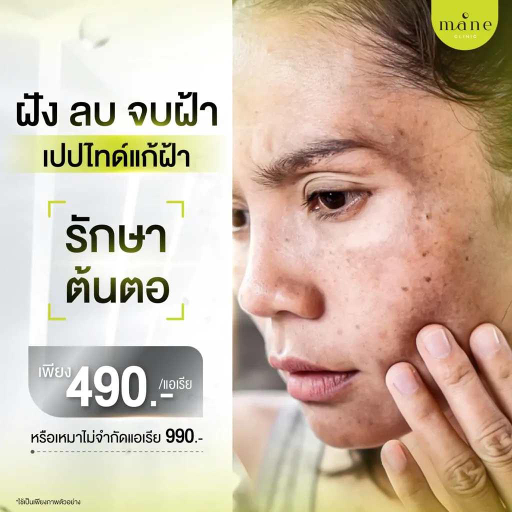ฝัง ลบ จบฝ้า รักษาต้นตอ