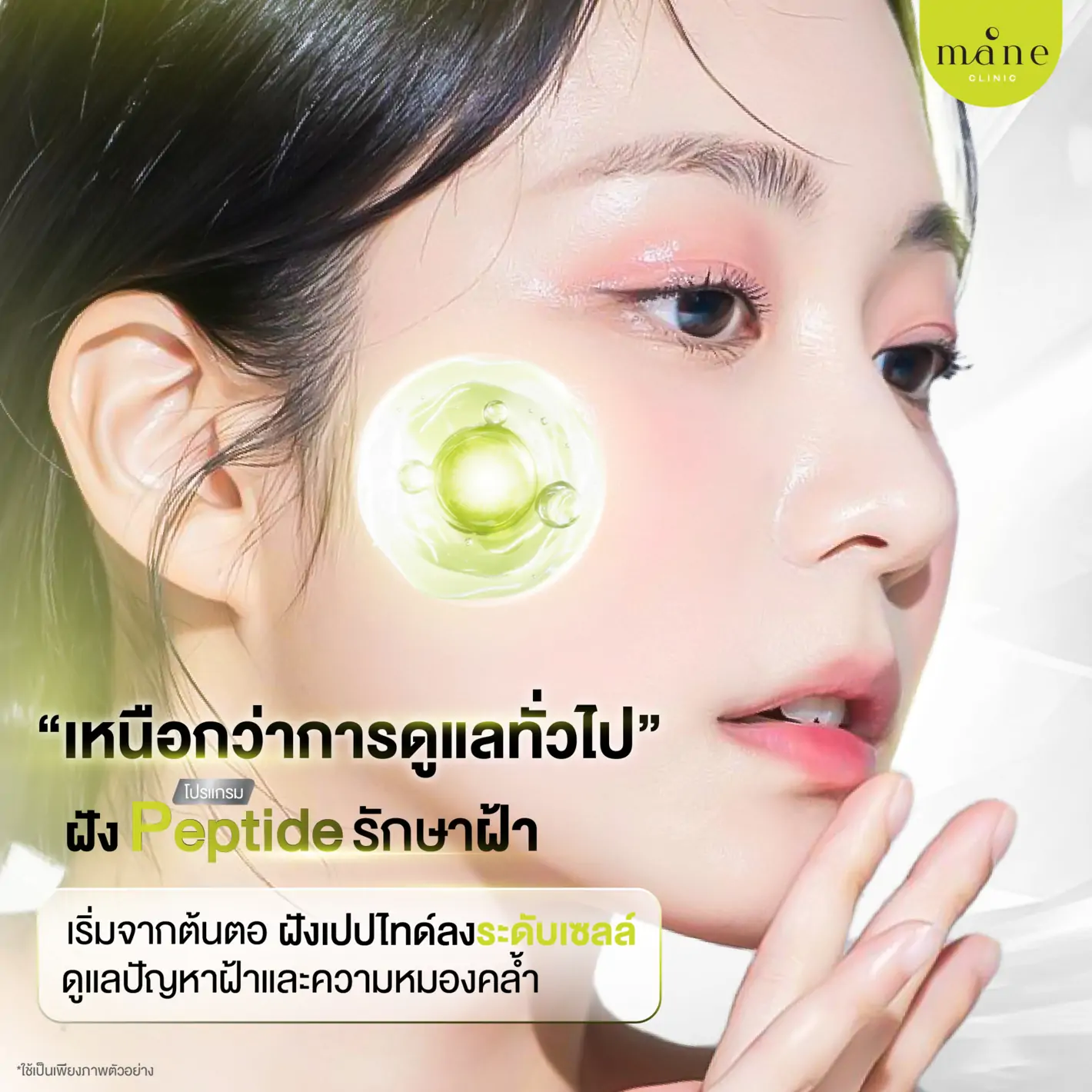 เหนือกว่าการดูแลทั่วไป ฝัง peptide รักษาฝ้า