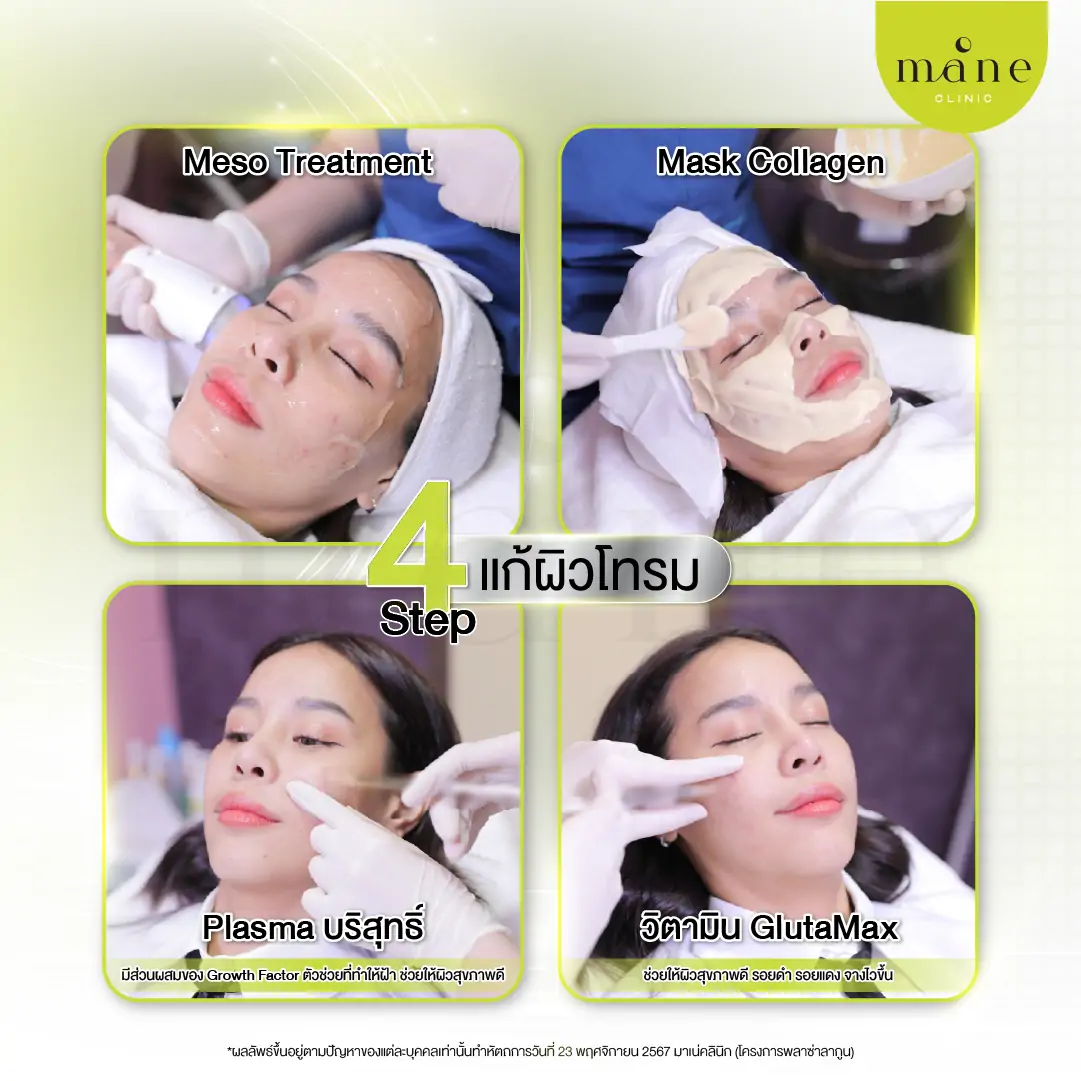 4 step แก้ผิวโทรม