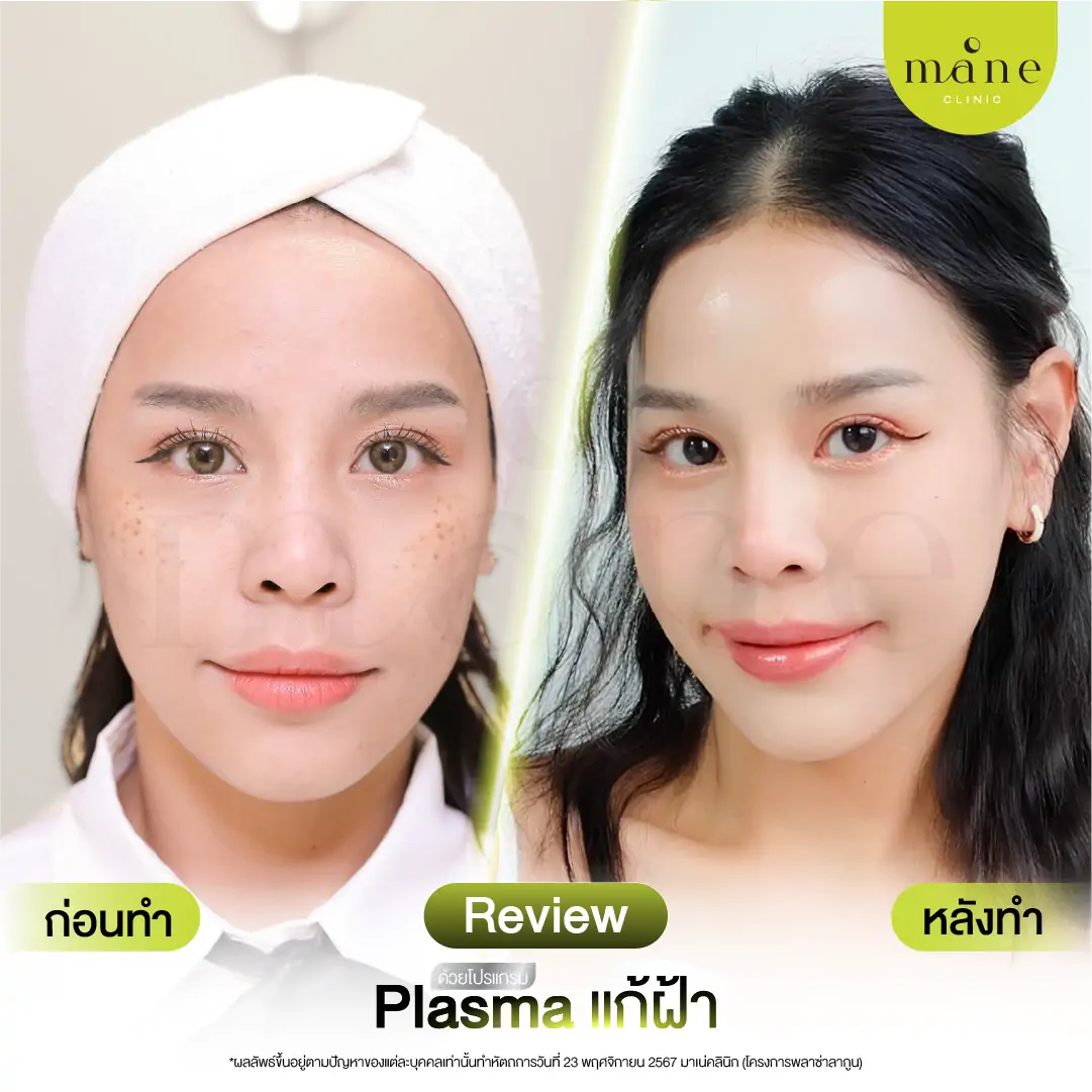ก่อนทำ-หลังทำ