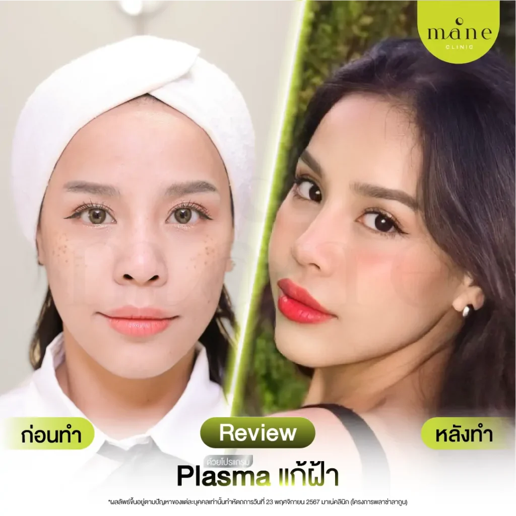 ก่อนทำ-หลังทำ