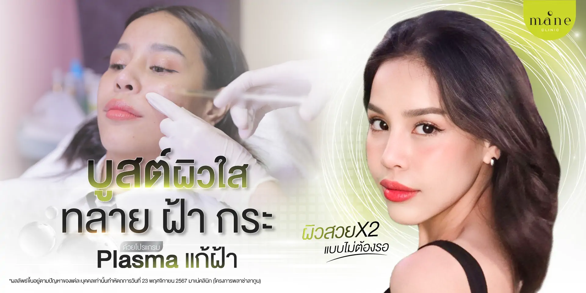 บูสต์ผิวใส ทลาย ฝ้า กระ