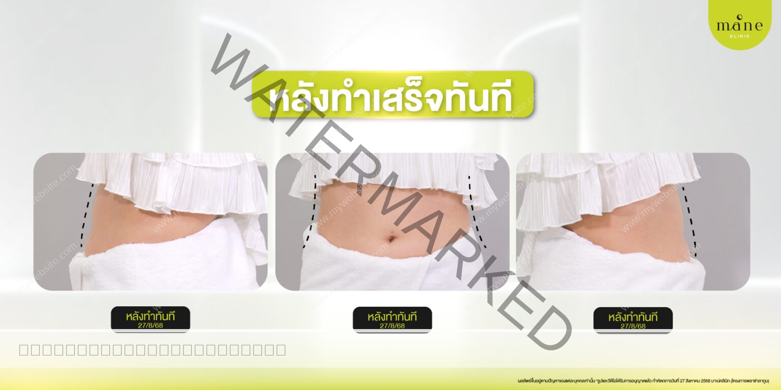 หลังทำทันที