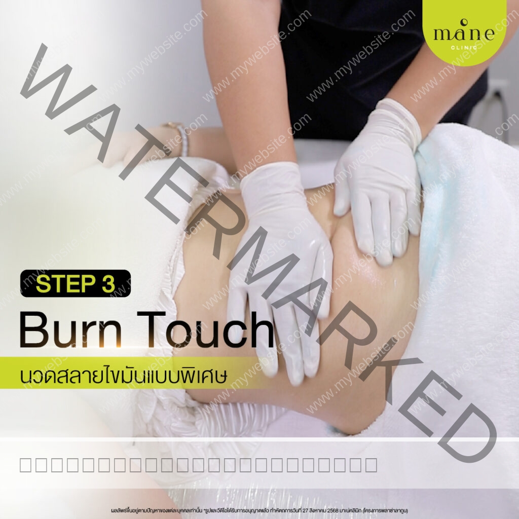 burn touch