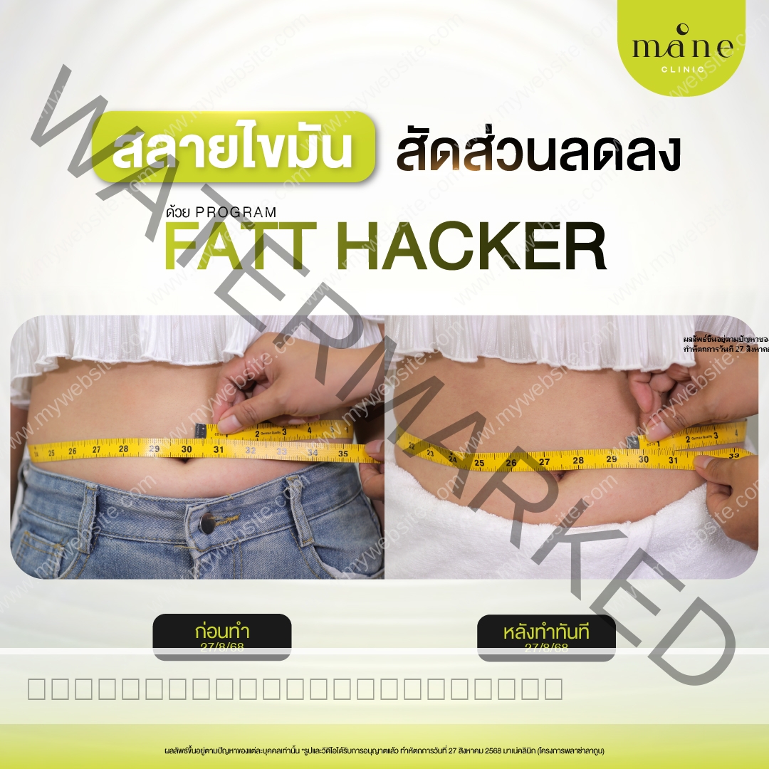 สลายไขมัน สัดส่วนลดลง