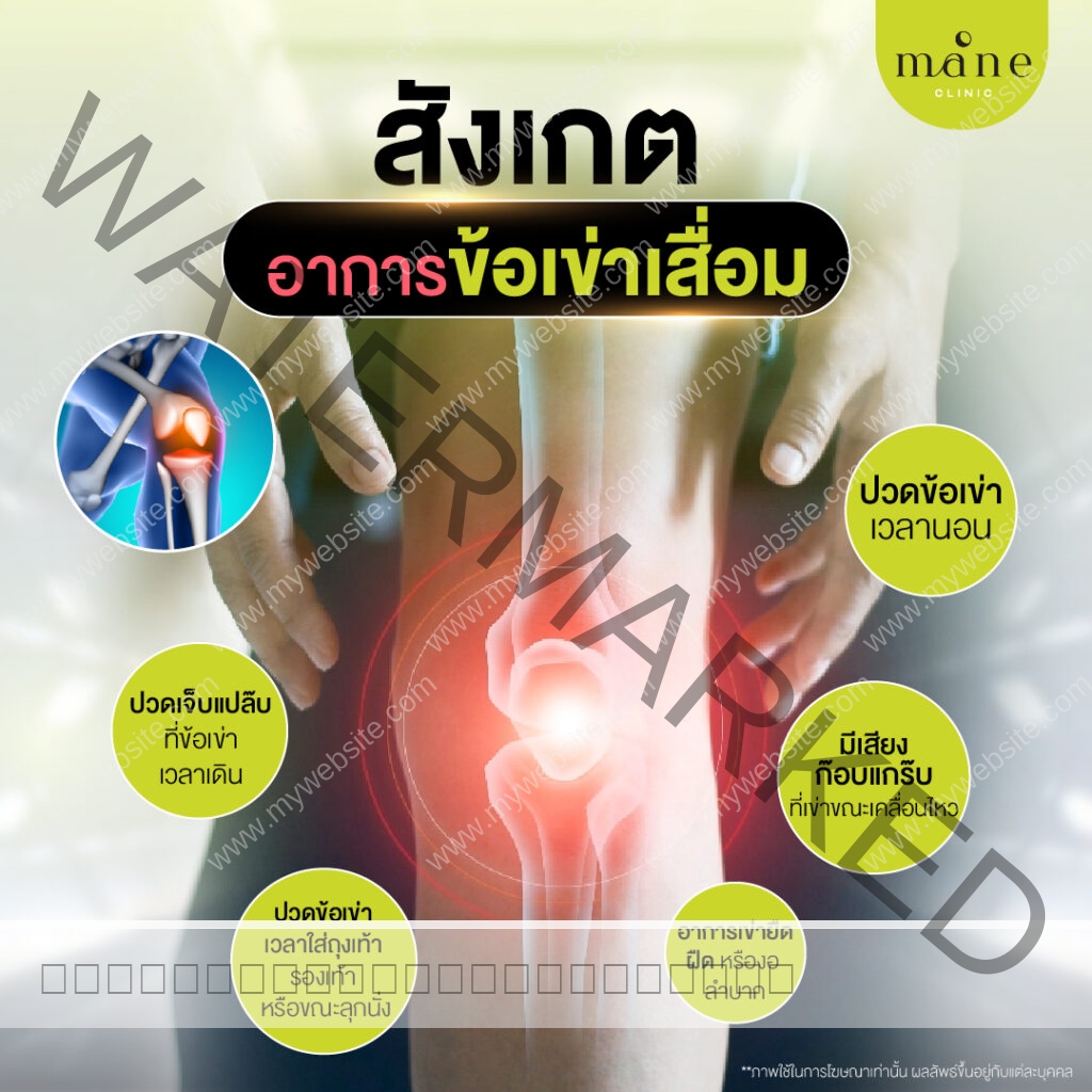สังเกตอาการข้อเข่าเสื่อม