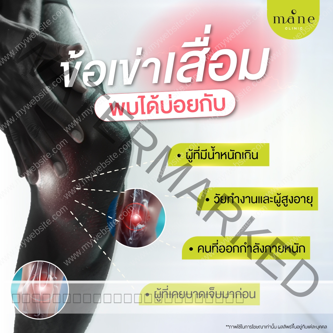 อาการข้อเข่าเสื่อม