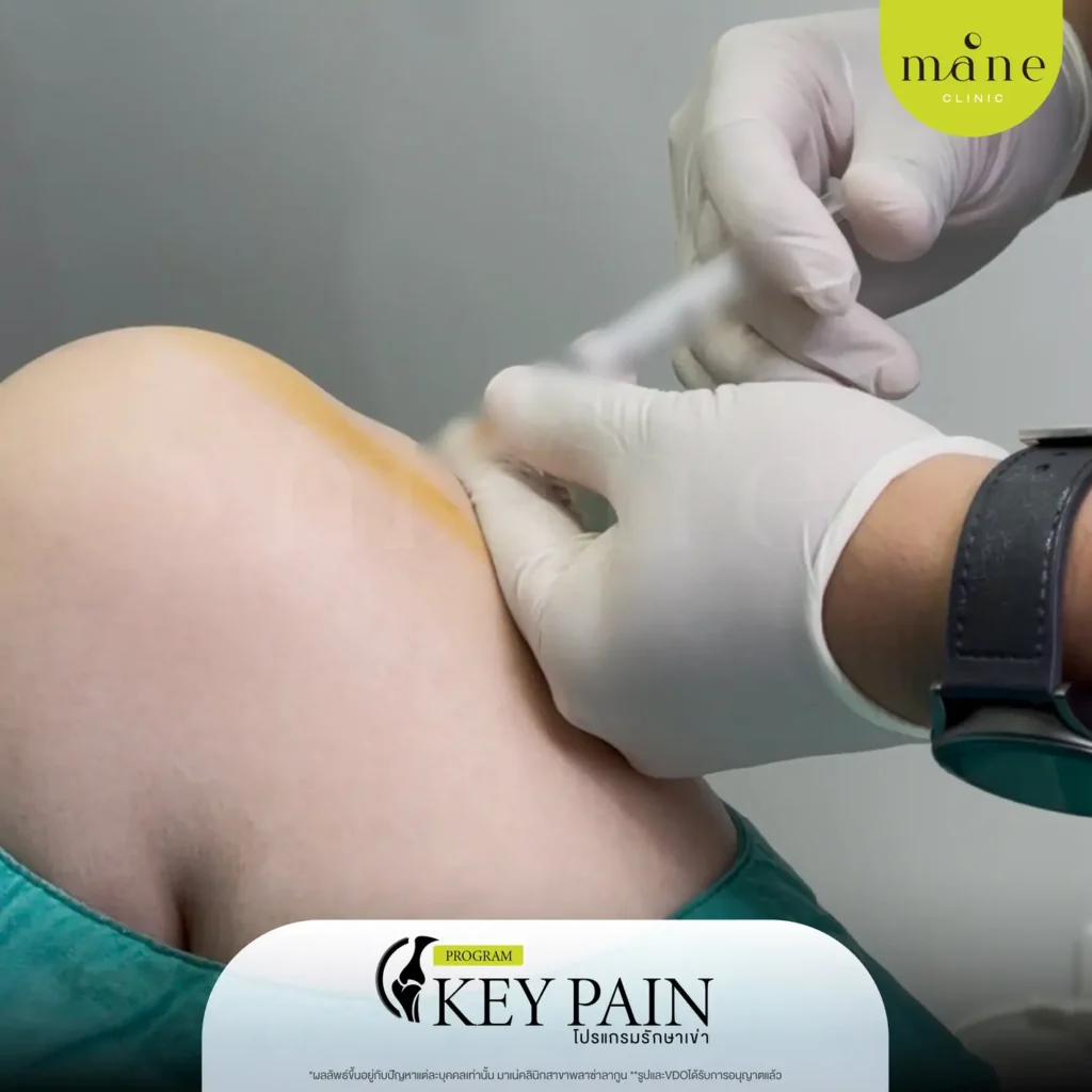 ฉีดข้อเข่า