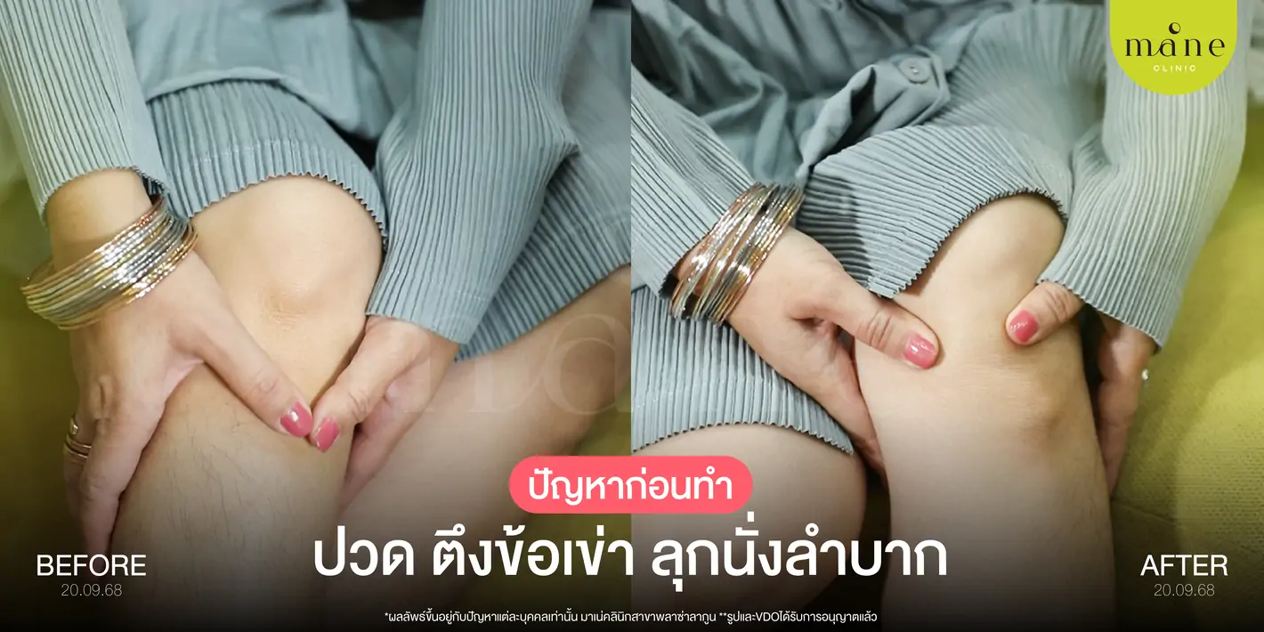 ปวด ตึงข้อเข่า ลุกนั่งลำบาก