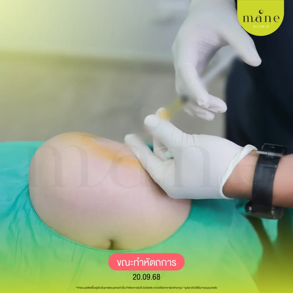 ระหว่างทำโปรแกรม Key Pain