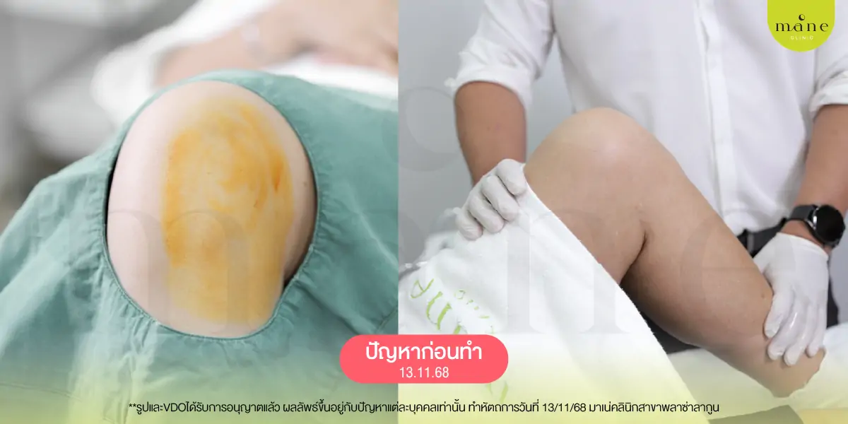 ปัญหาก่อนทำ