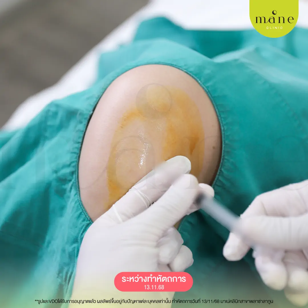 ระหว่างทำโปรแกรม Key Pain