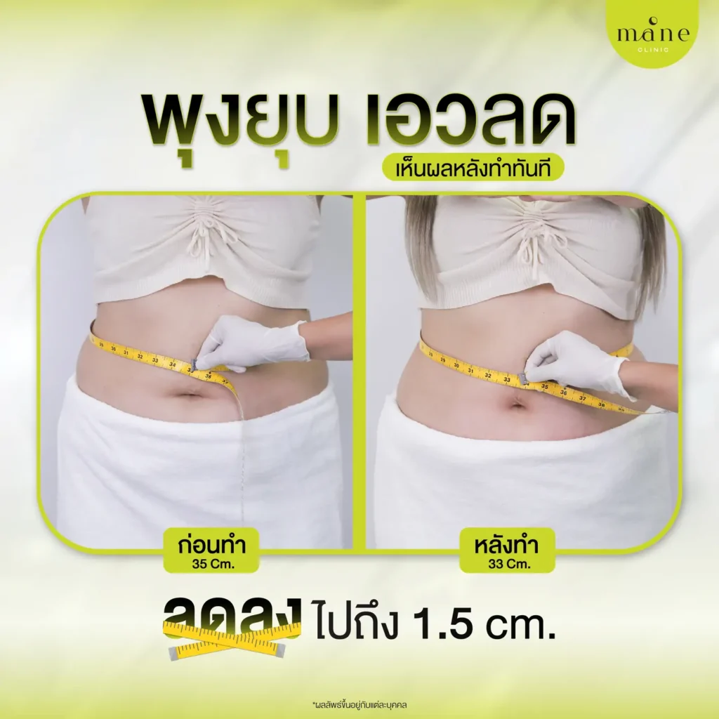 พุงยุบ เอวลด