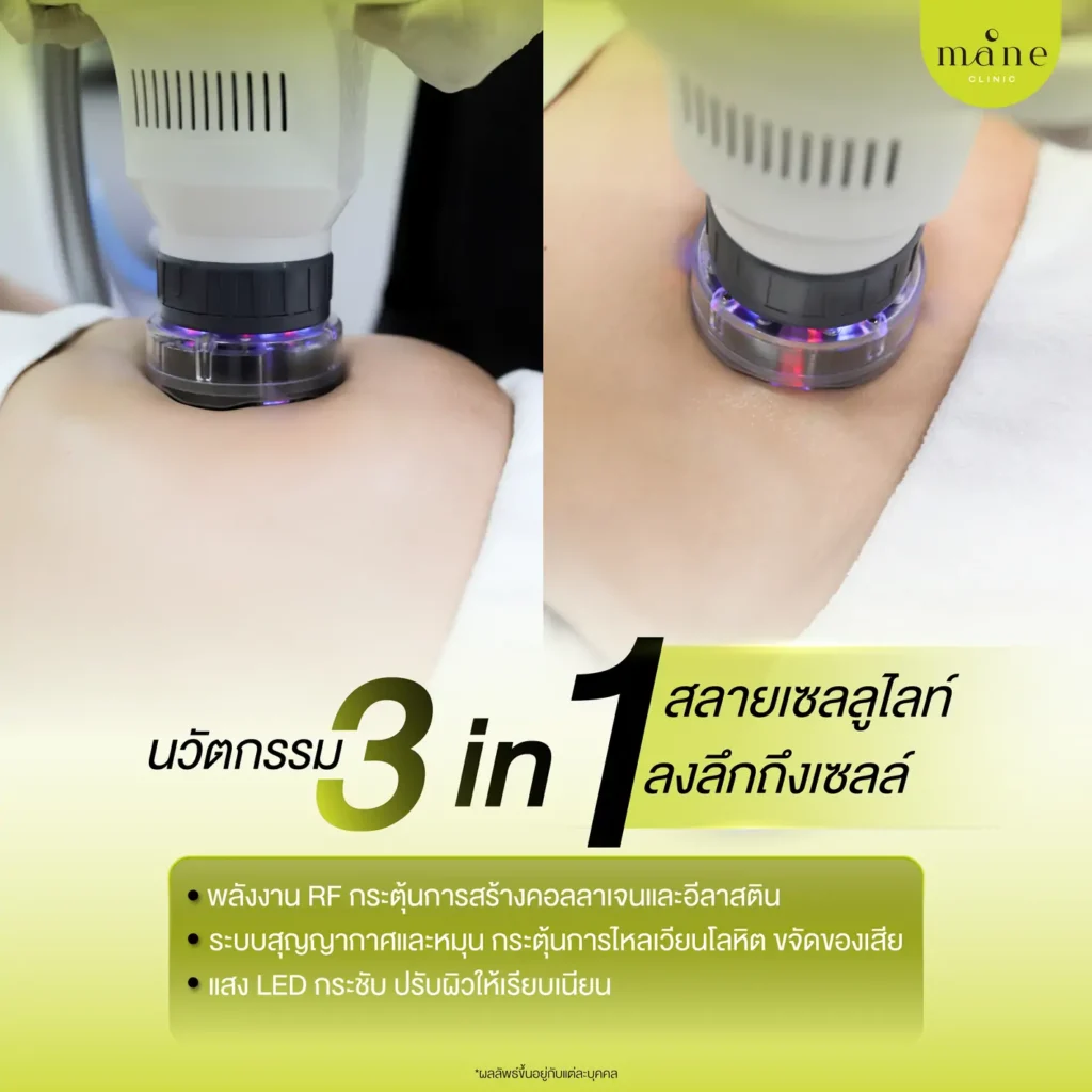 นวัตกรรม 3 in 1
