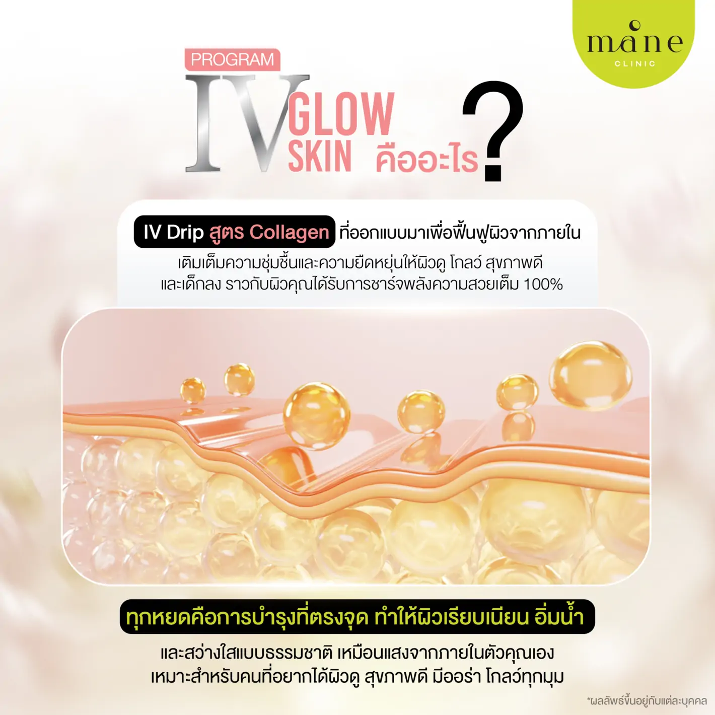 IV GLOW SKIN คืออะไร