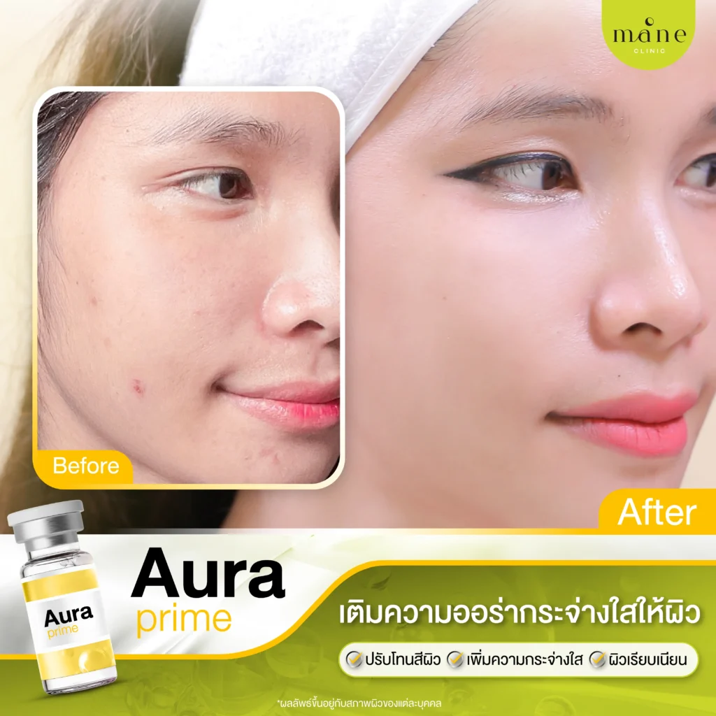 ผลลัพธ์หลังทำ