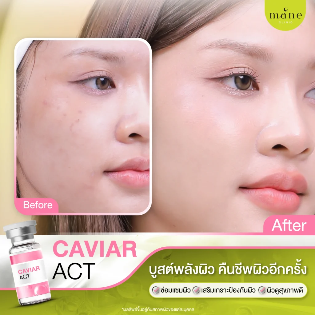 ผลลัพธ์หลังทำ