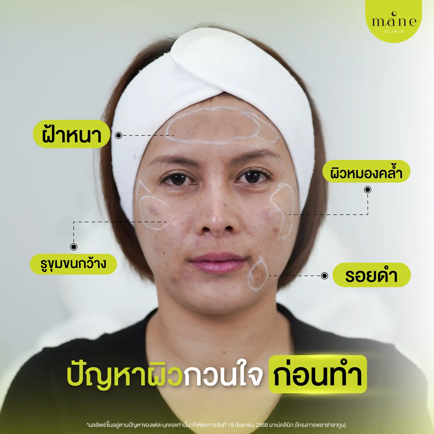 ปัญหาผิวกวนใจ ก่อนทำ