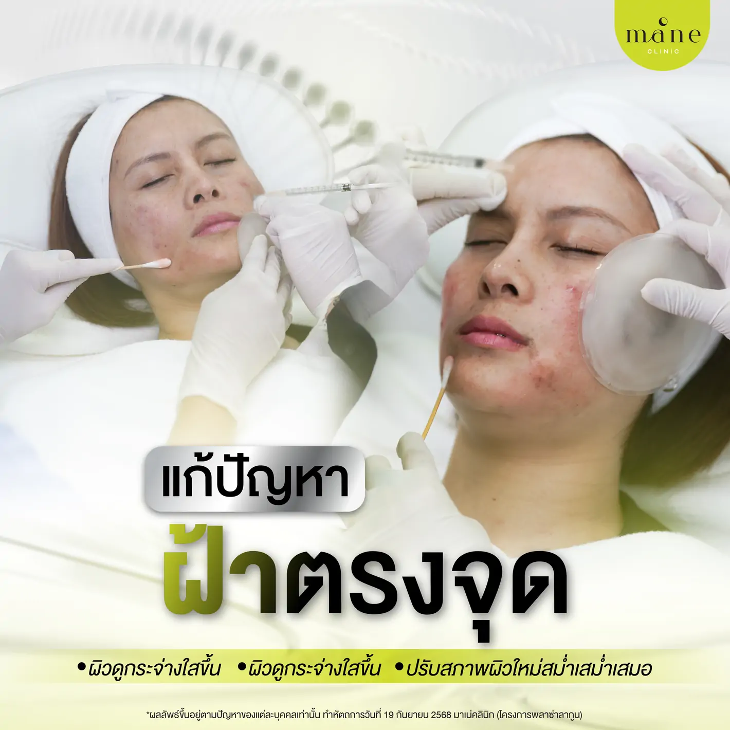 แก้ปัญหาฝ้าตรงจุด