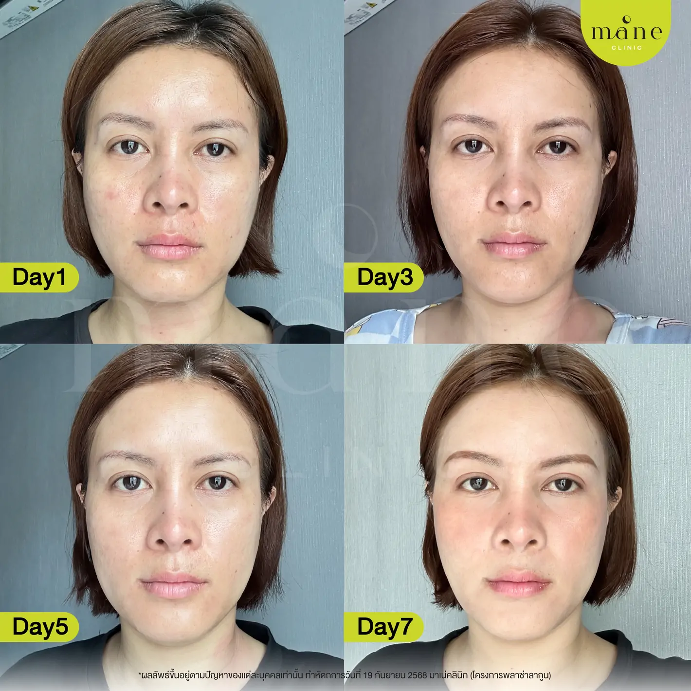 ความรู้สึกหลังทำ