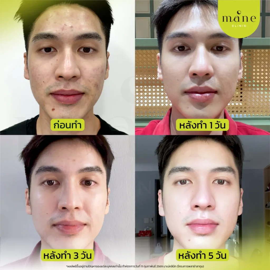 หลังทำทันที