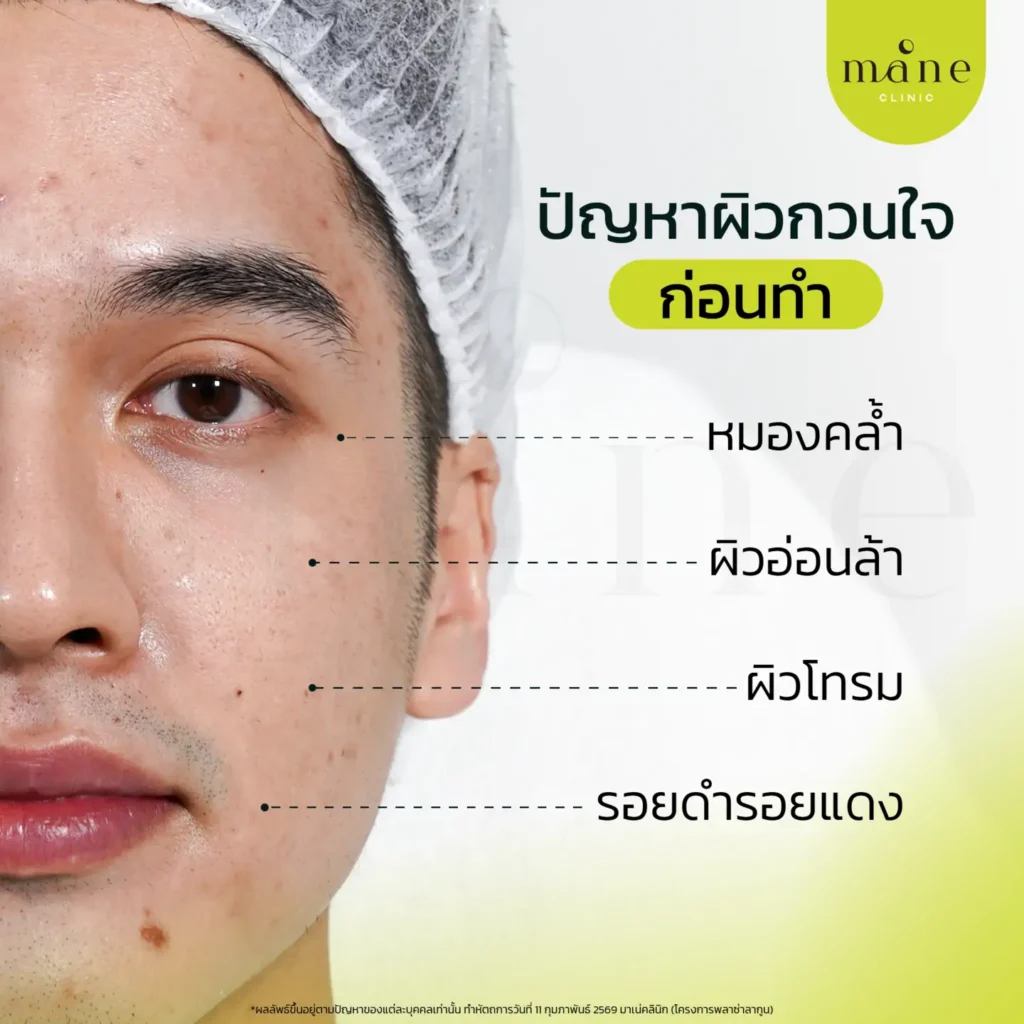 ปัญหาผิว