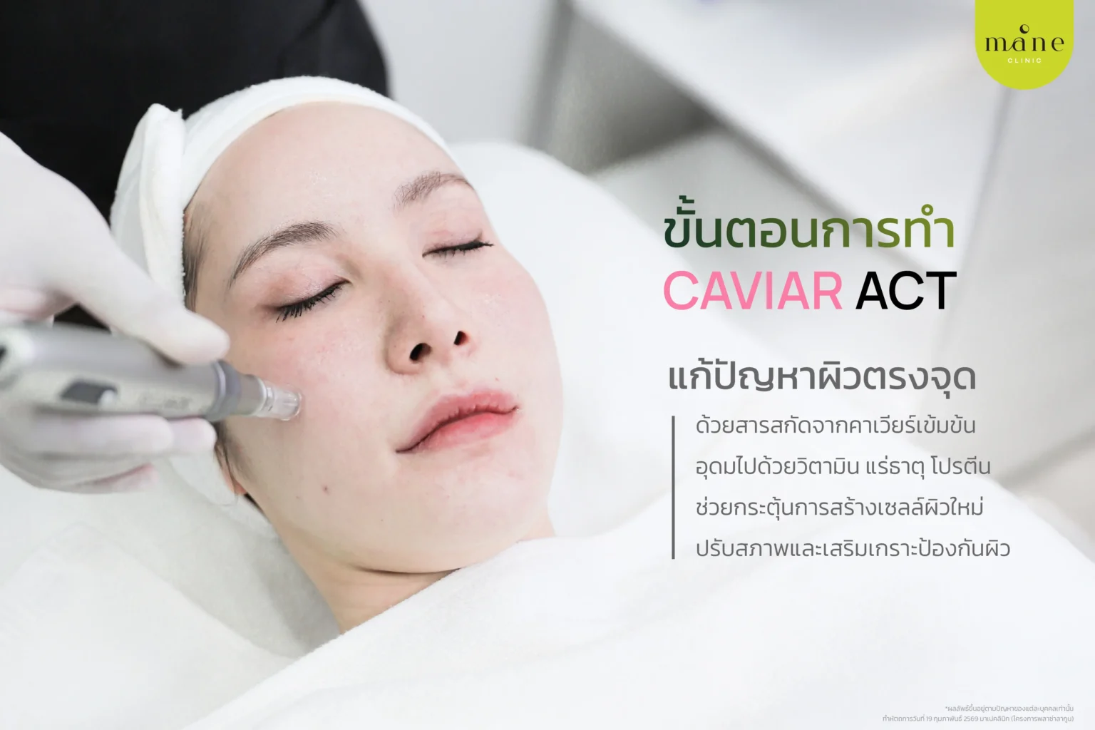 ขั้นตอนการทำ Caviar Act