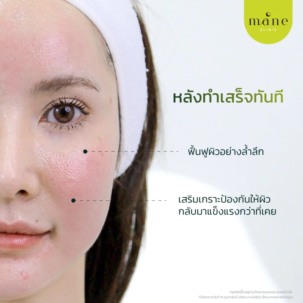 หลังทำทันที