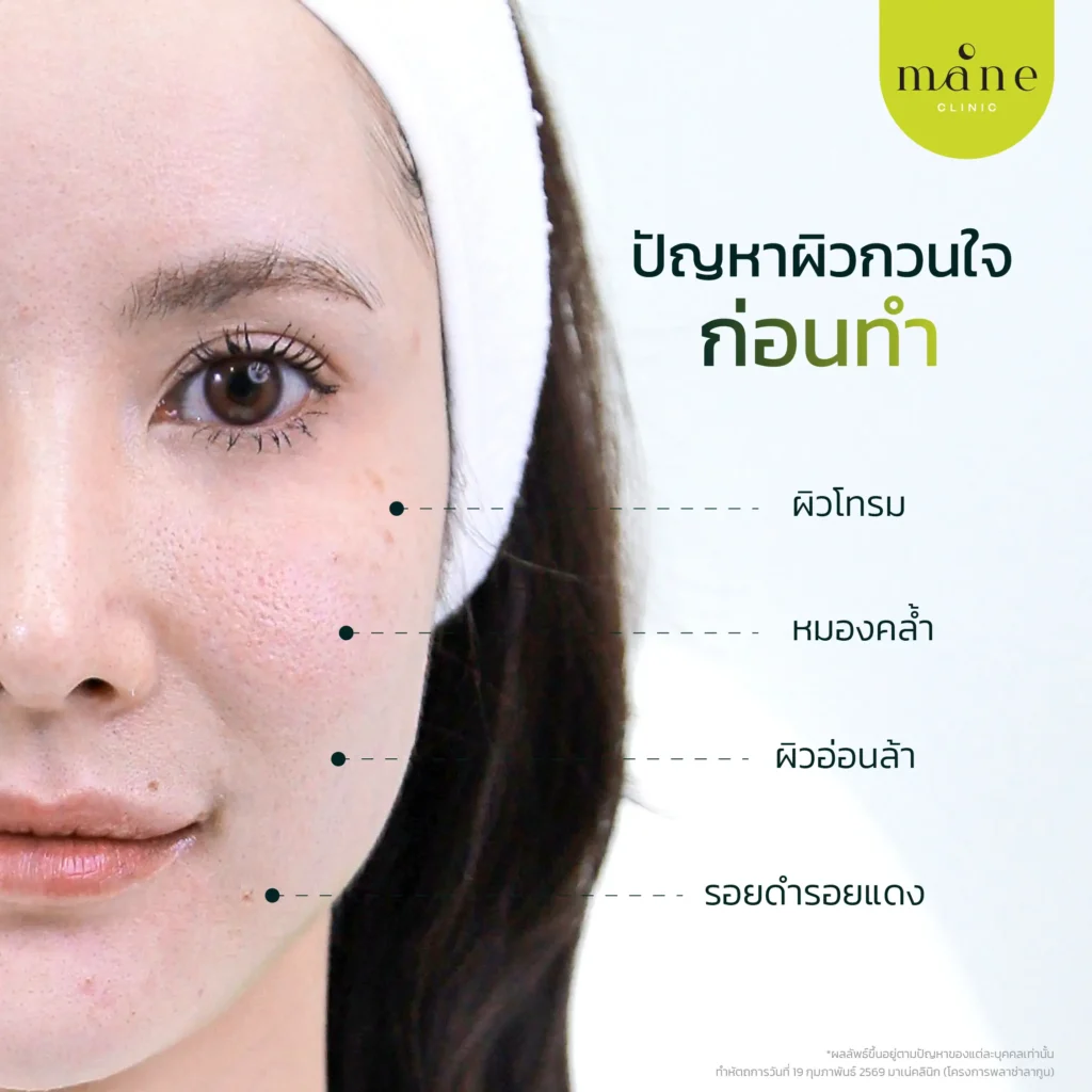 ปัญหาผิวกวนใจก่อนทำ