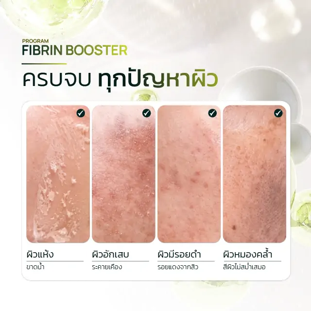 ใครบ้างที่ควรลอง Fibrin Boost ?