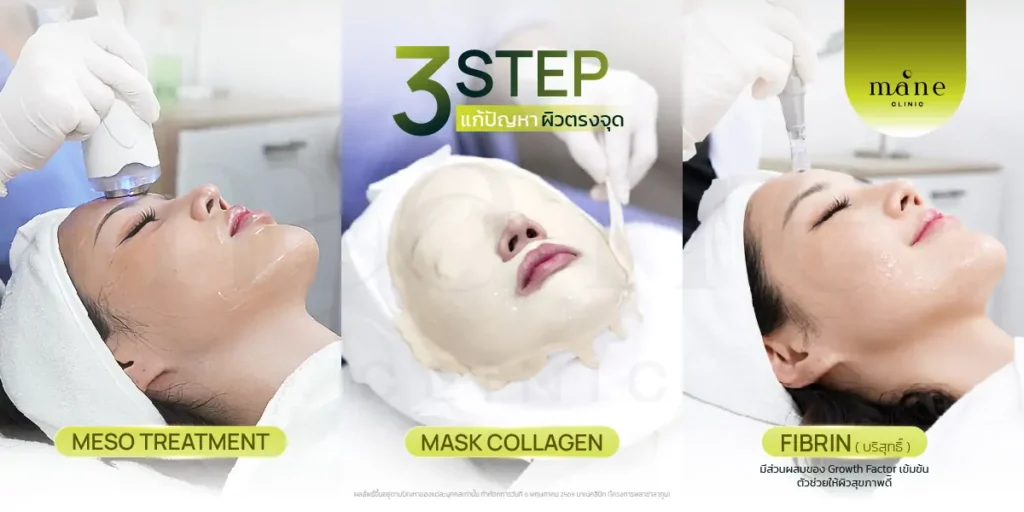 3 step