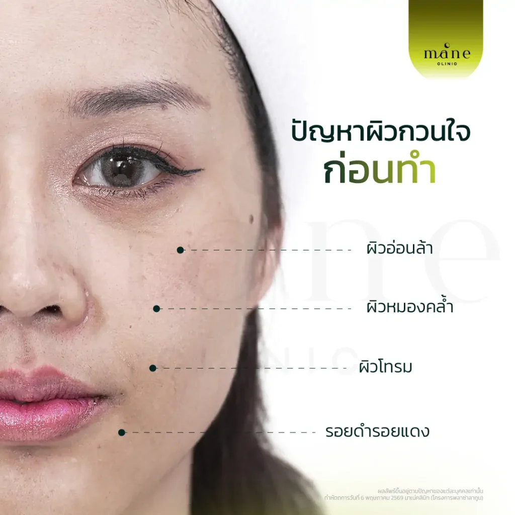 ปัญหาที่เห็นชัดเลยคือผิวดูโทรม