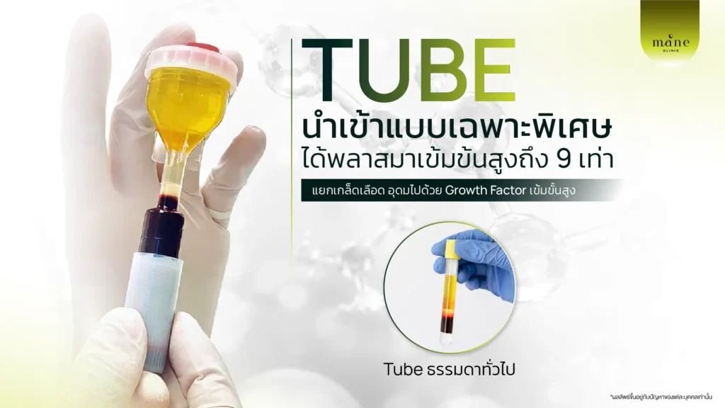 โปรแกรม Fibrin Booster สารสกัดจาก Plasma นำมาทำอะไรกับผิวหน้า ?