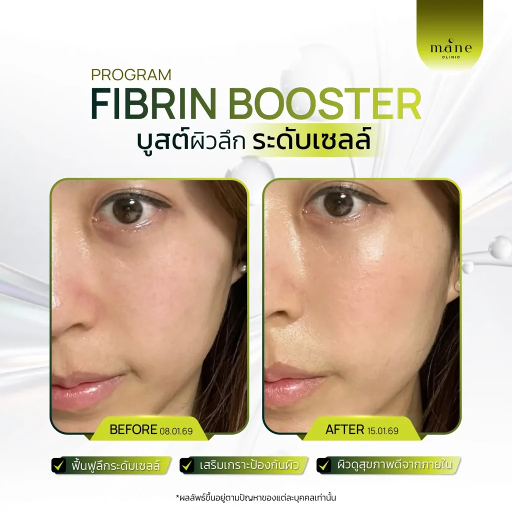 fibrin booster ฟื้นฟูระดับเซลล์