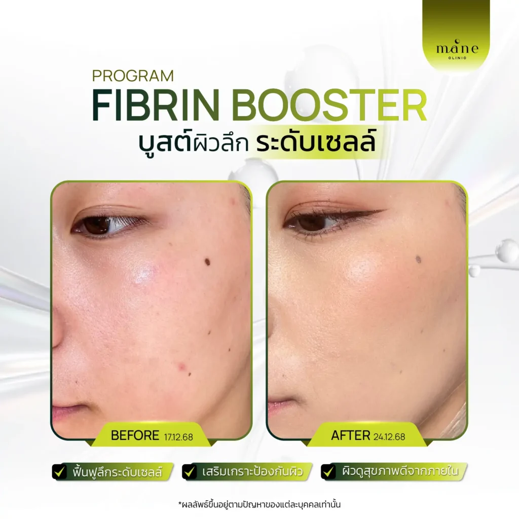 fibrin booster ฟื้นฟูระดับเซลล์