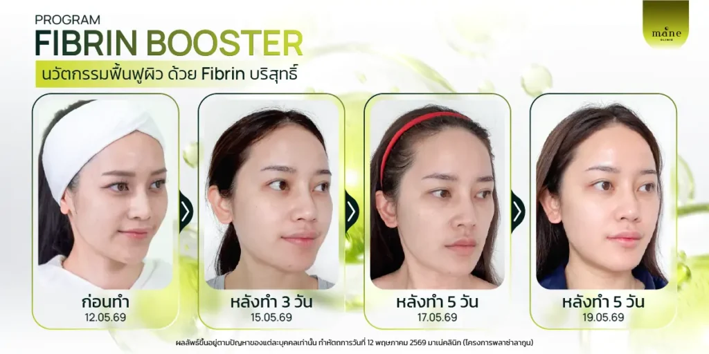Fibrin Booster