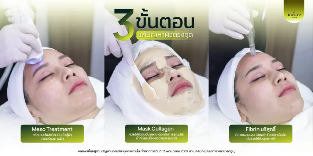 3 ขั้นตอน